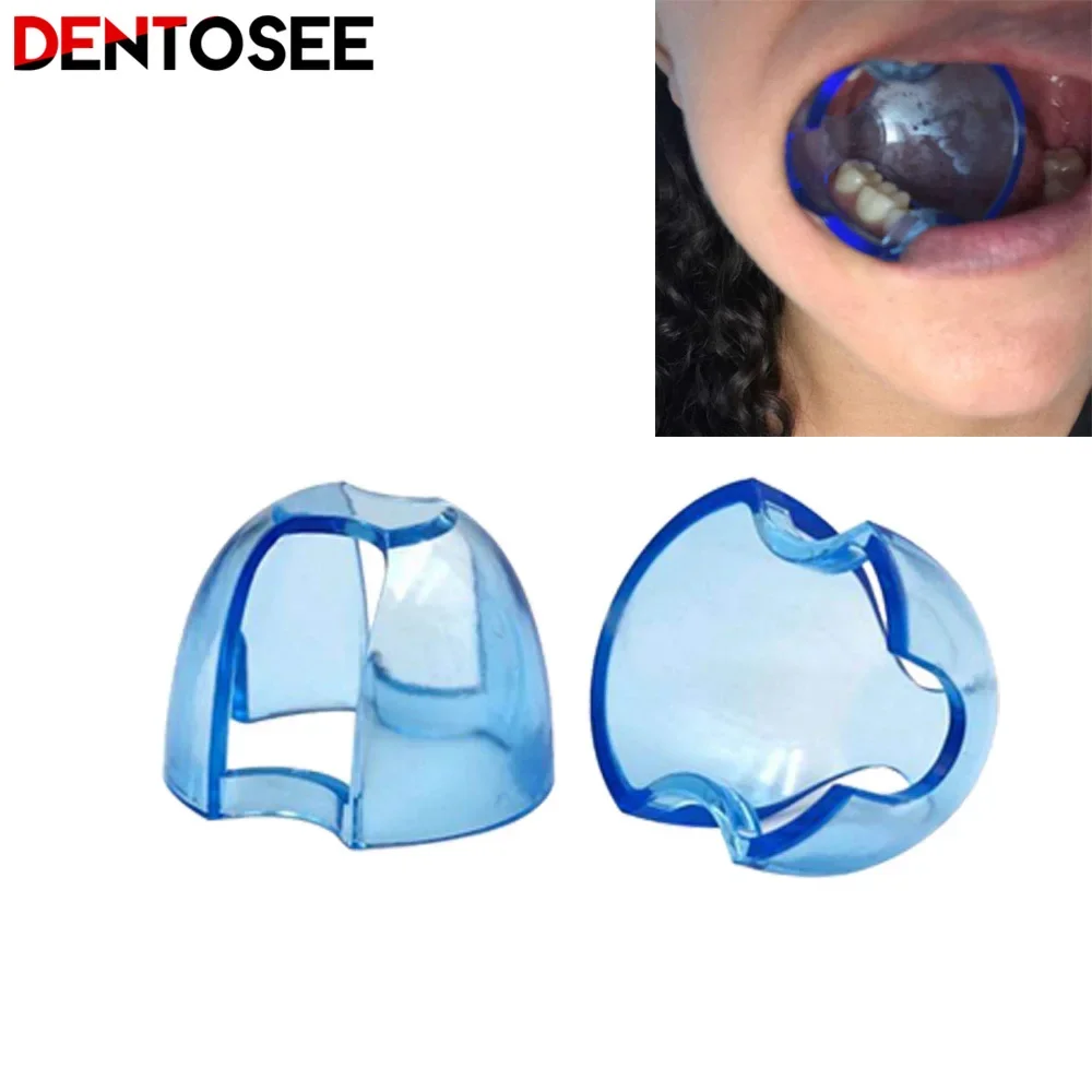 Teeth Whitening Accelerator - Dental Intraoral Cheek Retractor Lip Mouth