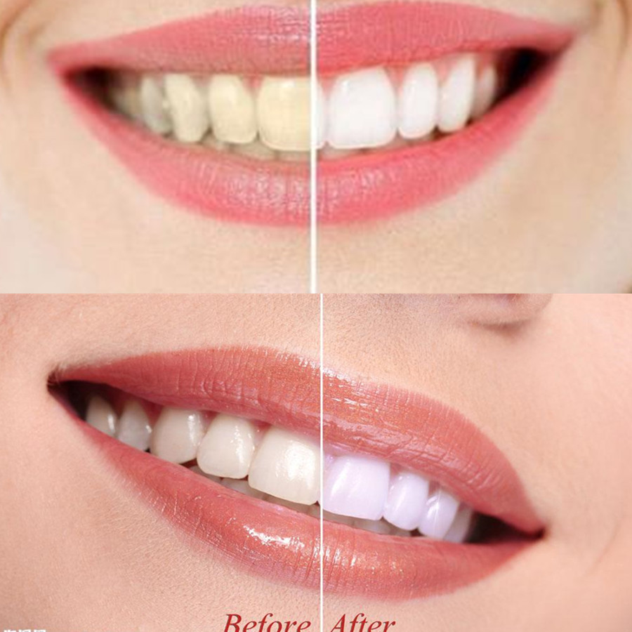 Bamboo Charcoal Teeth Tooth De - Teeth Whitening Instant ulasan dan harga