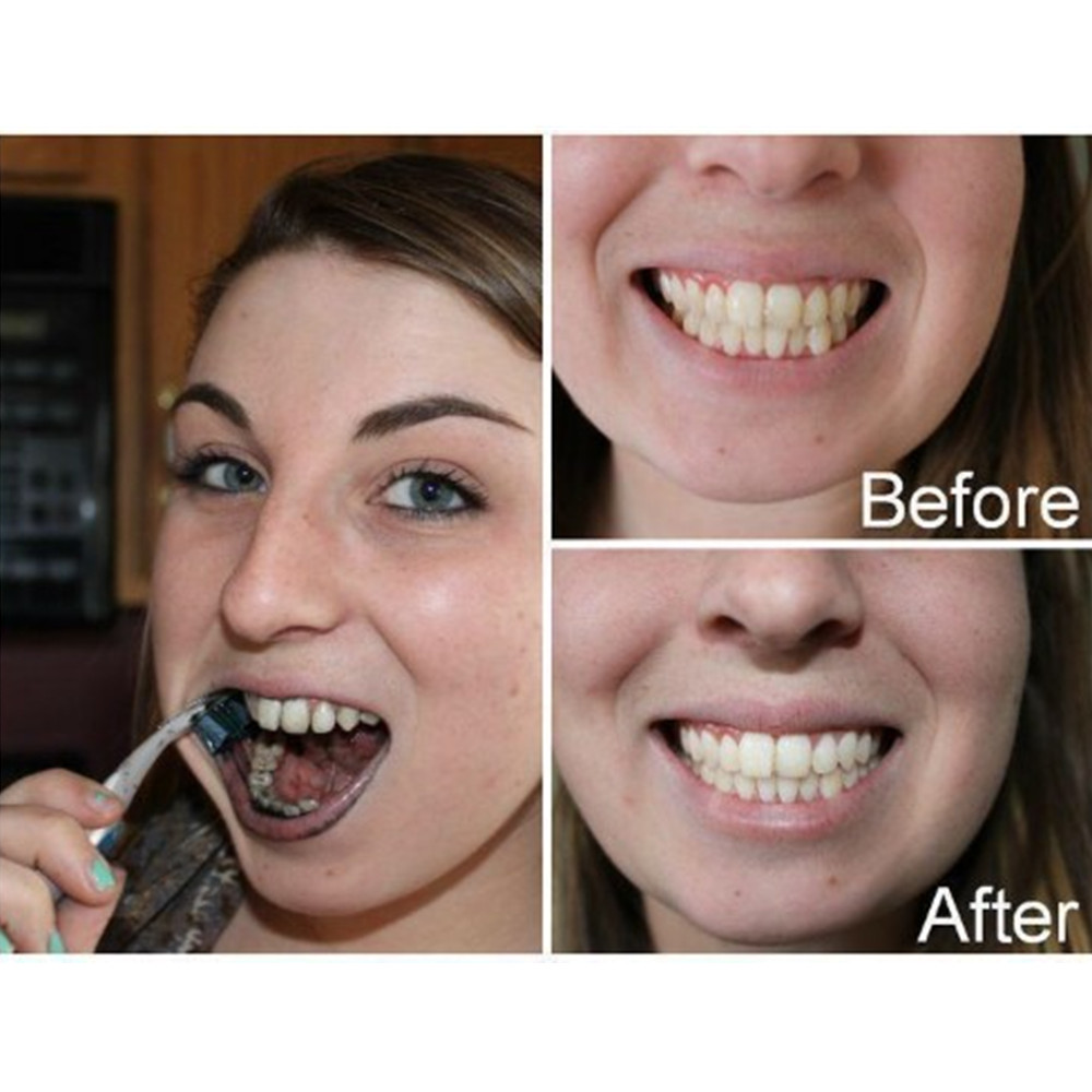 Bamboo Charcoal Teeth Tooth De - Teeth Whitening Instant ulasan dan harga