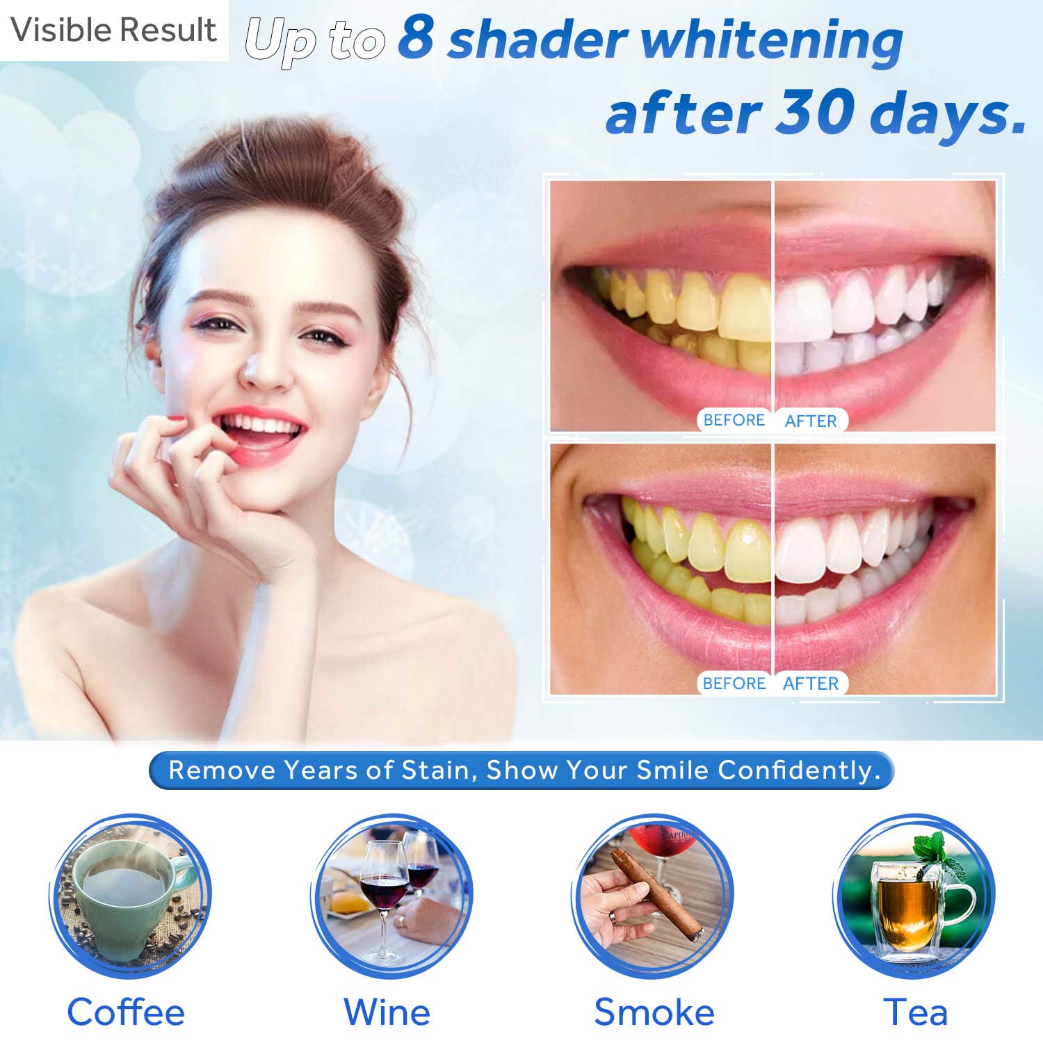 Teeth Whitening Gel Refill Syr - Teeth Whitening Gel Pen ulasan dan harga