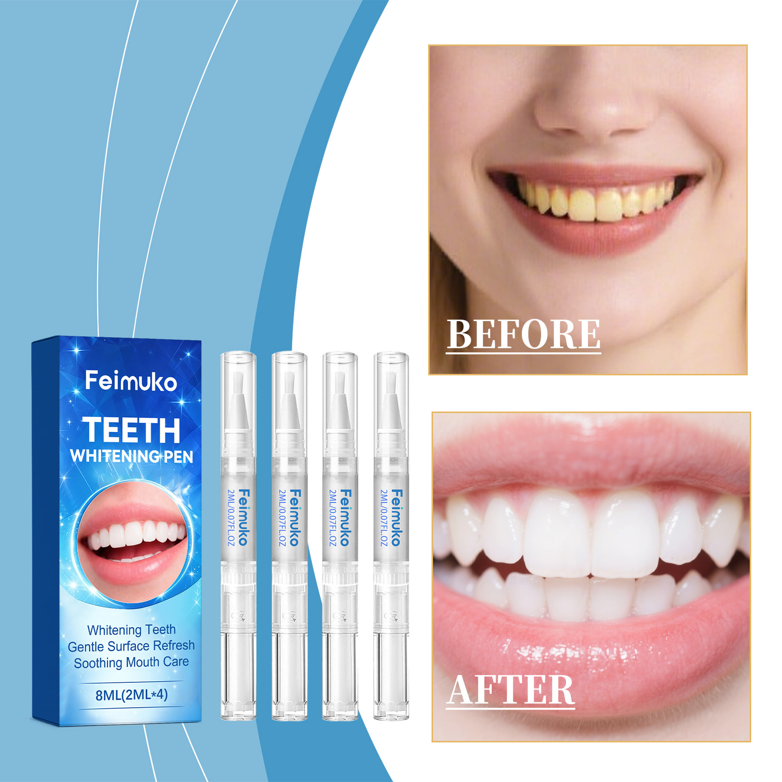 Feimuko 8ml Teeth Gel Pen Gent - Teeth Whitening Gel Pen ulasan dan harga