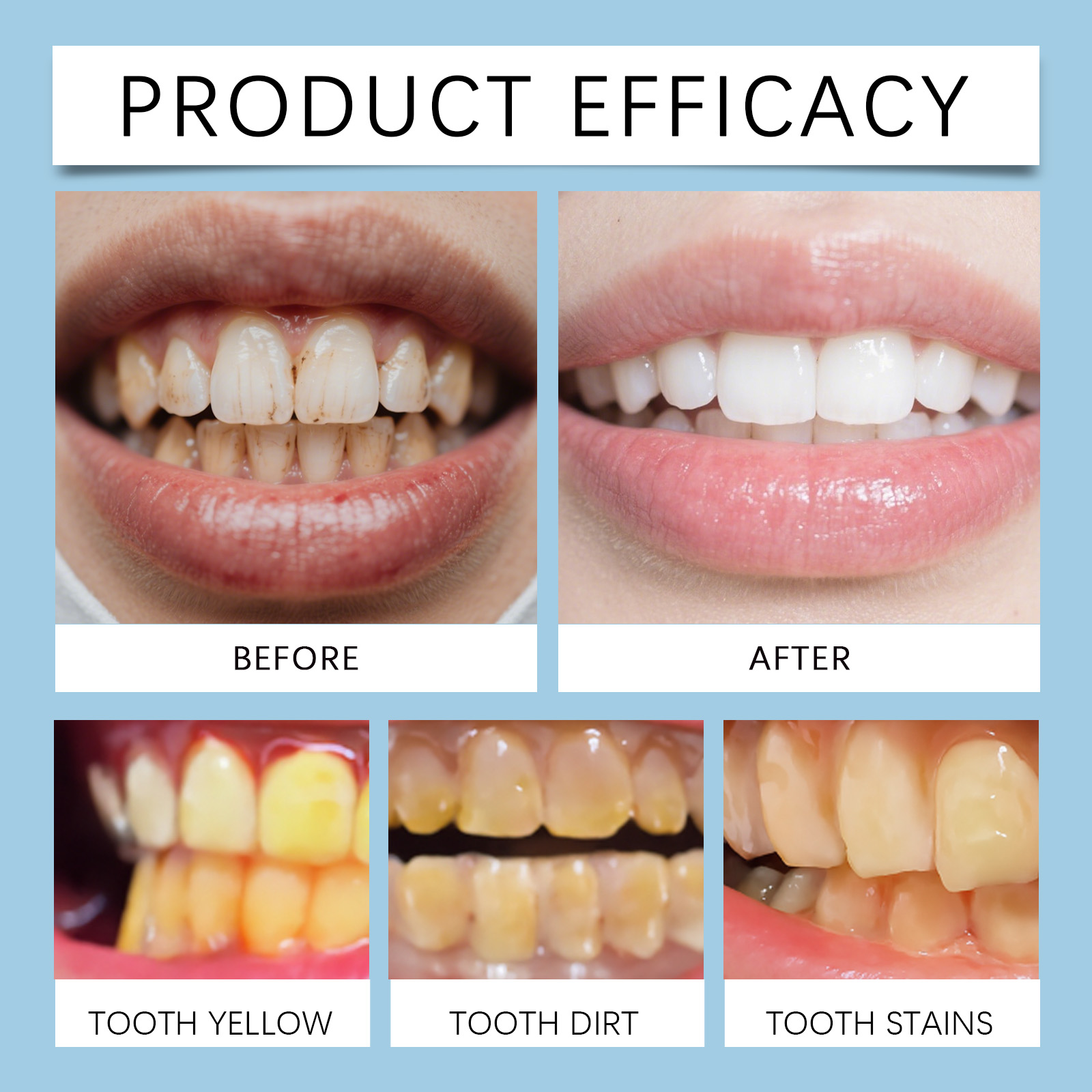 Feimuko 8ml Teeth Gel Pen Gent - Teeth Whitening Gel Pen ulasan dan harga