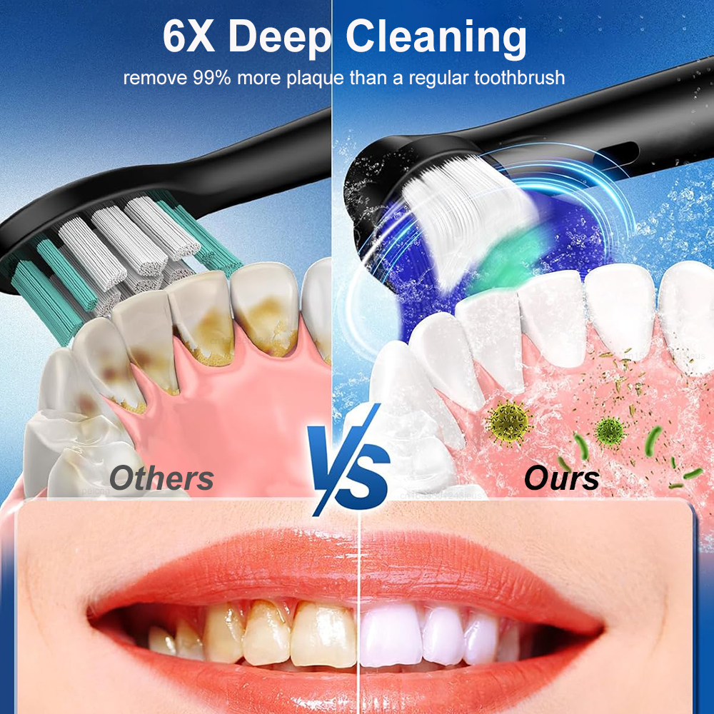 Electric Toothbrush Rotary Rec - Teeth Whitening Toothbrush ulasan dan harga