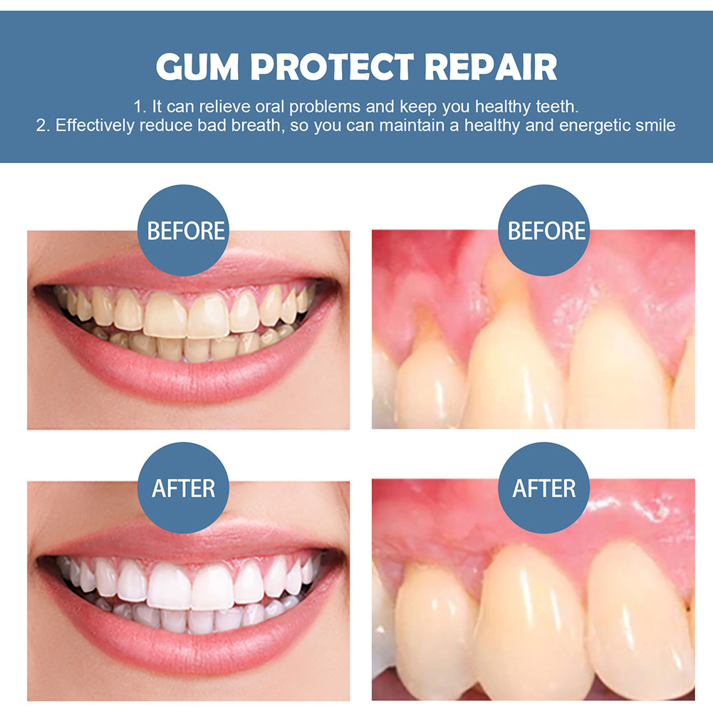 Gum Protection Repair Gel Reli - Teeth Whitening Gel Pen ulasan dan harga