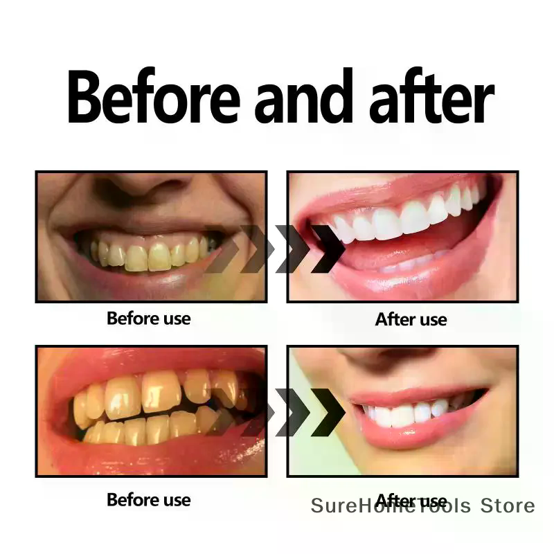 Bamboo Charcoal Powder For Tee - Teeth Whitening Instant ulasan dan harga