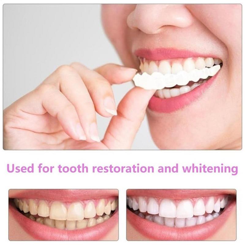 Snap On Teeth Veneers Instant  - Teeth Whitening Instant ulasan dan harga