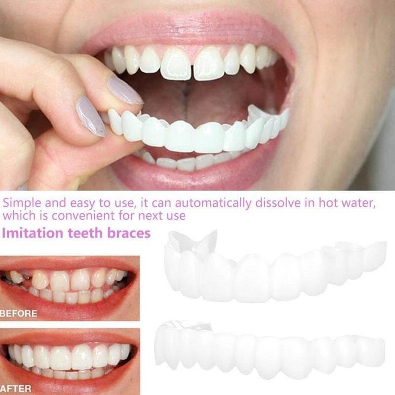 Snap On Teeth Veneers Instant  - Teeth Whitening Instant ulasan dan harga