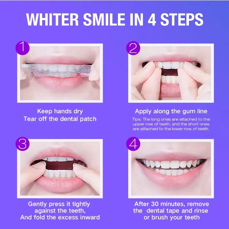 Teeth Whitening Kit - 5X LED L - Teeth Whitening Kit ulasan dan harga