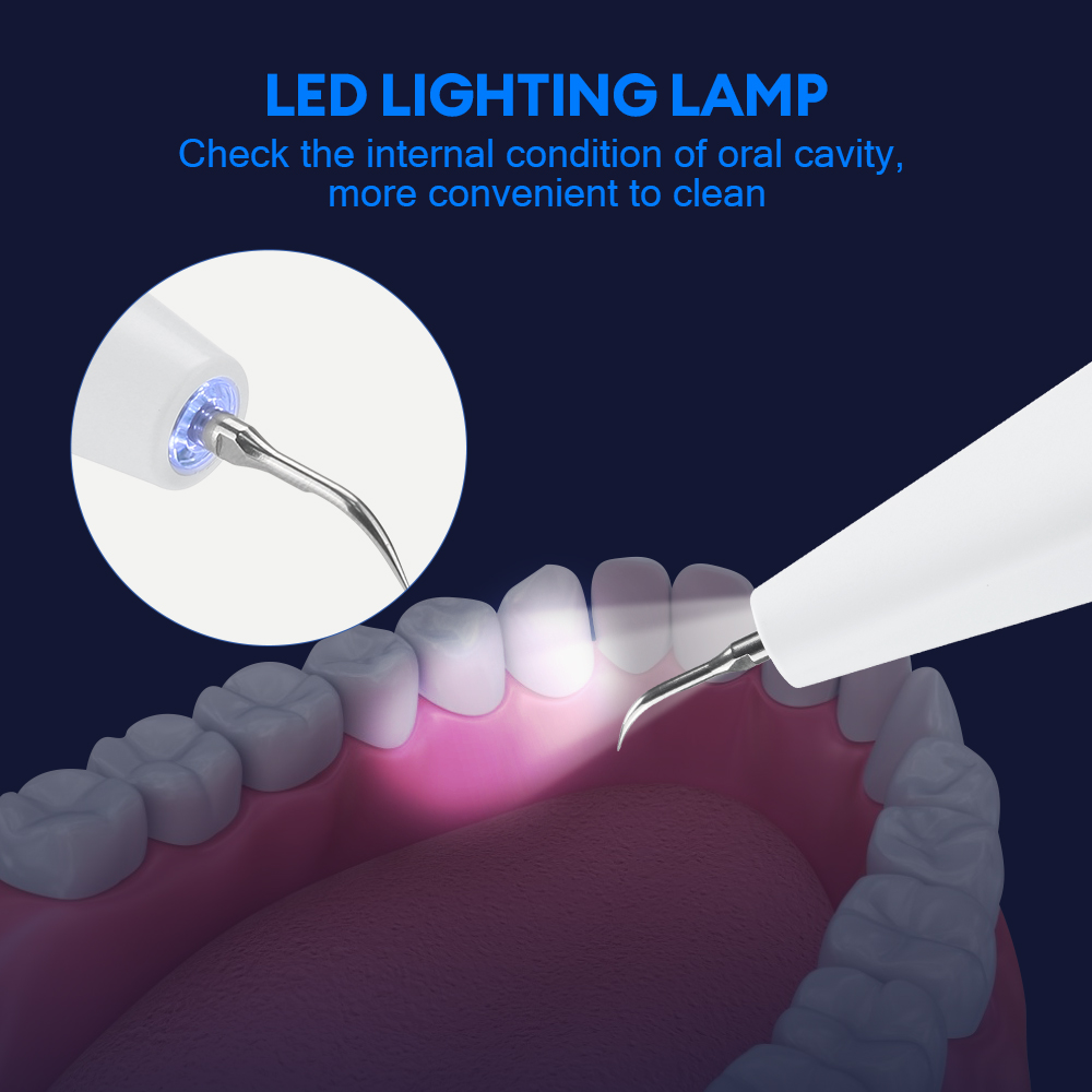 Ultrasonic Dental Calculus Rem - Teeth Whitening Kit ulasan dan harga
