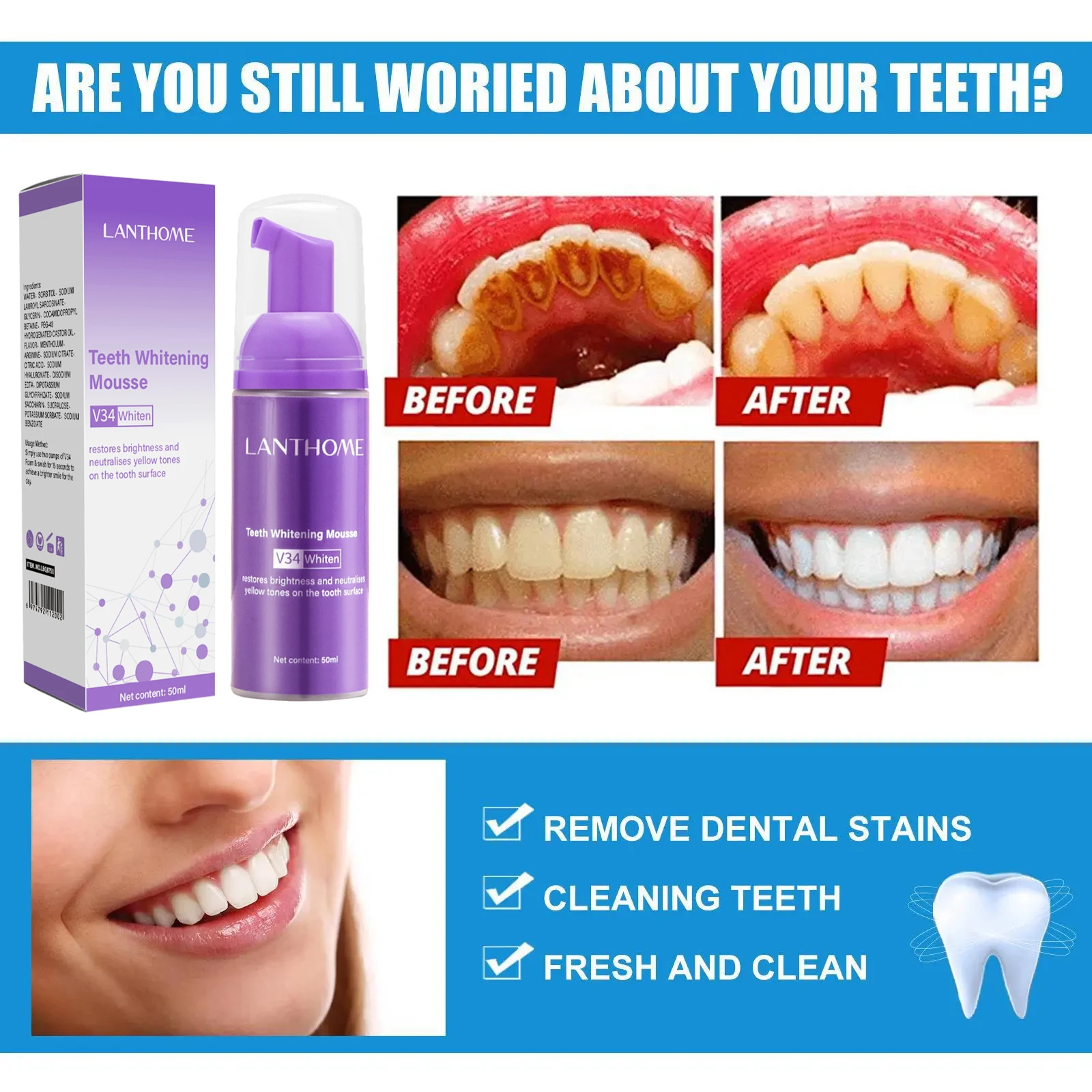 V34 Teeth Whitening Mousse Too - Teeth Whitening/Bleaching ulasan dan harga