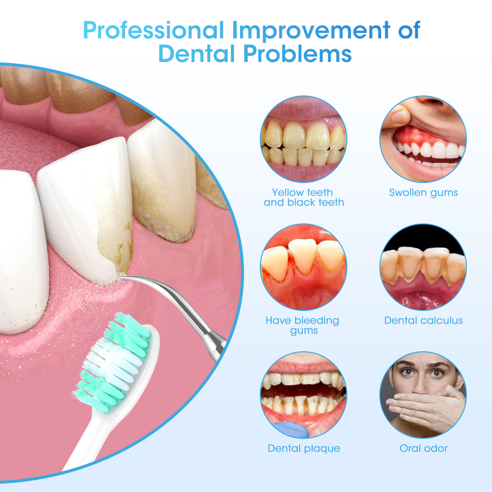 Electric Teeth Cleaner Sonic D - Teeth Whitening Toothbrush ulasan dan harga