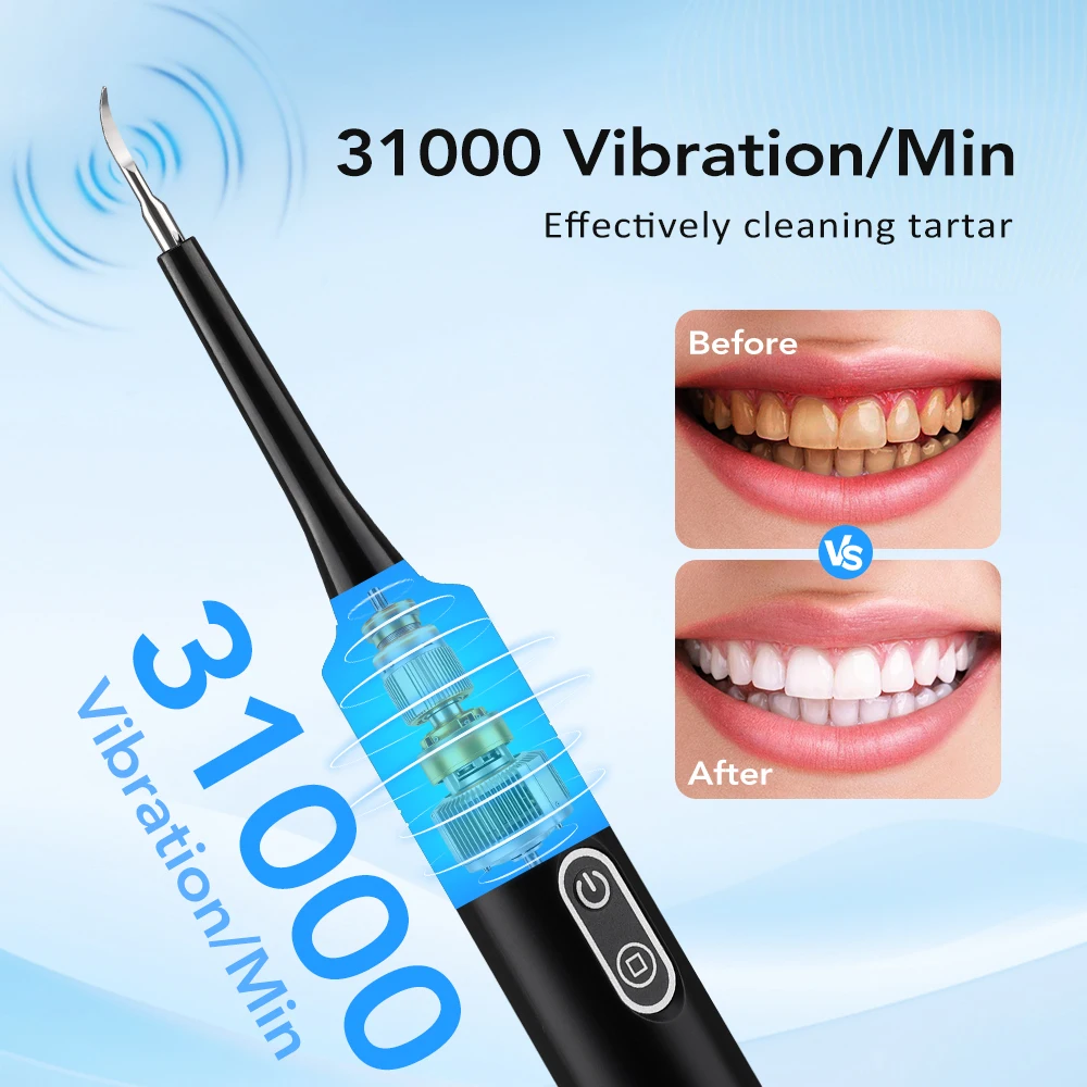 Electric Sonic Vibration Denta - Teeth Whitening Toothbrush ulasan dan harga